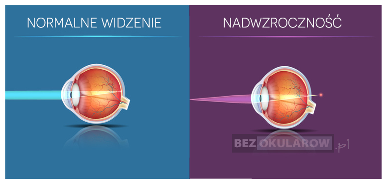 Różnice między normalnym widzeniem a nadzwrocznością