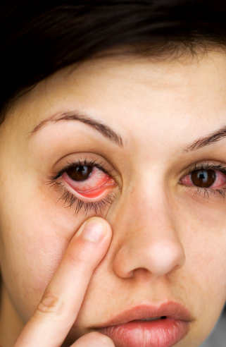 Objawy zapalenia błony naczyniowej oka